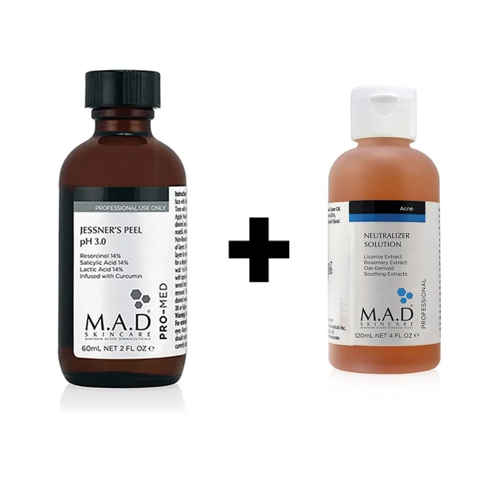 پیلینگ شیمیایی اسید جسنر ام ای دی M.A.D